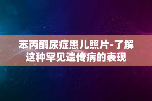 苯丙酮尿症患儿照片-了解这种罕见遗传病的表现